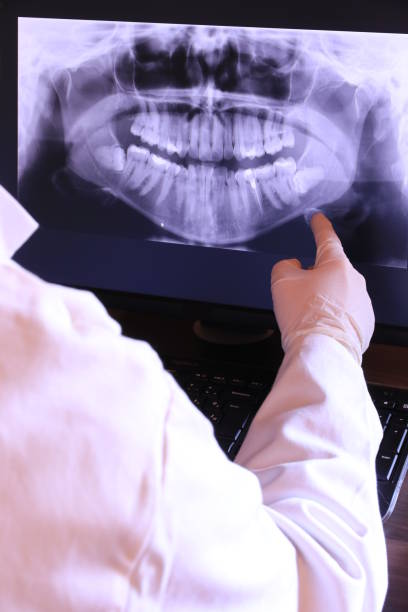 Best Emergency Tooth Extraction in Hampshire, IL