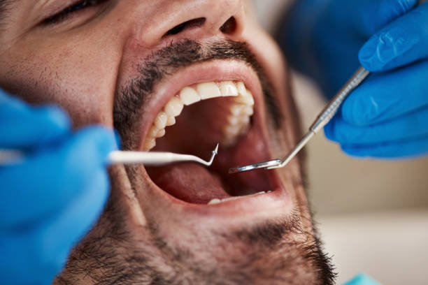 Best Emergency Dental Care for Trauma or Injury in Hampshire, IL