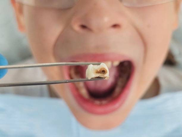 Best Pediatric Emergency Dentist in Hampshire, IL